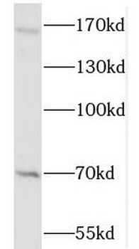NSD3 Antibody