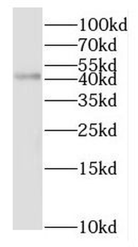 NSDHL Antibody