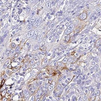 NSDHL Rabbit Polyclonal Antibody