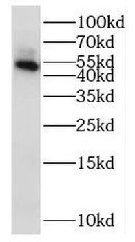 NSUN5 Antibody