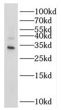 NTHL1 Antibody
