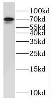 NUAK2 Antibody