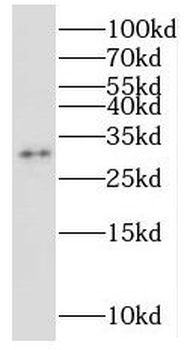 NUBP2 Antibody