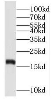 NUDCD2 Antibody