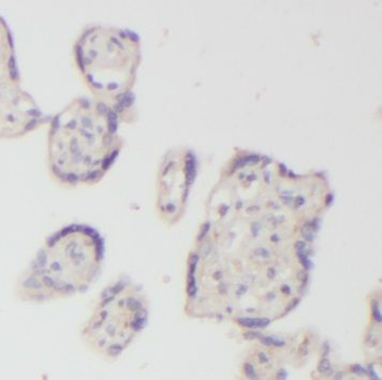 NUDT21 Rabbit Polyclonal Antibody