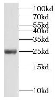NUDT3 Antibody