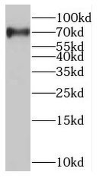 NUMB Antibody