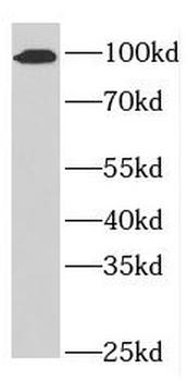 NUP98 Antibody
