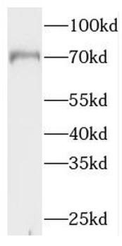 NXF2 Rabbit Polyclonal Antibody