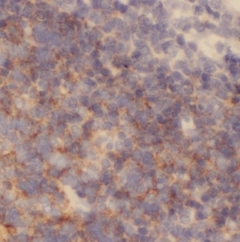NXF2 Rabbit Polyclonal Antibody