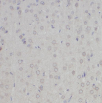 NYAP2 Rabbit Polyclonal Antibody