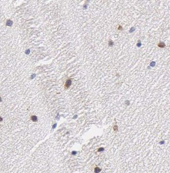 OAS3 Rabbit Polyclonal Antibody