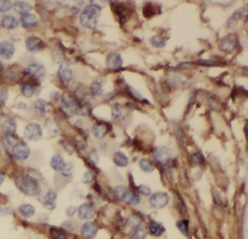 ODAM Antibody
