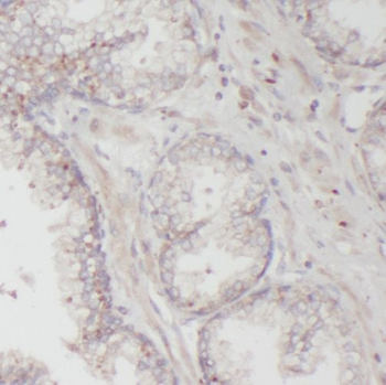 ODC1 Rabbit Polyclonal Antibody