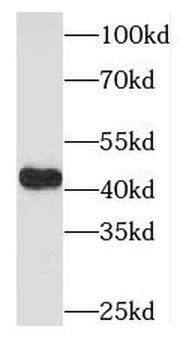 OFD1 Rabbit Polyclonal Antibody