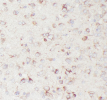 OFD1 Rabbit Polyclonal Antibody