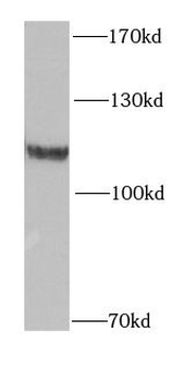 OGDH Antibody