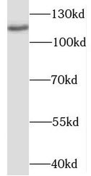 OGDHL Rabbit Polyclonal Antibody