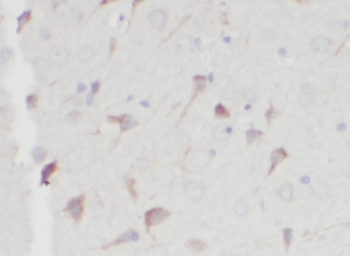 OGDHL Rabbit Polyclonal Antibody
