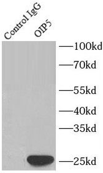 OIP5 Rabbit Polyclonal Antibody