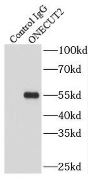 ONECUT2 Rabbit Polyclonal Antibody