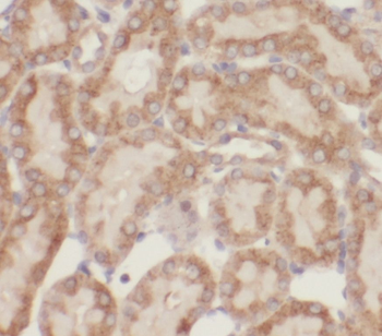 OPLAH Rabbit Polyclonal Antibody