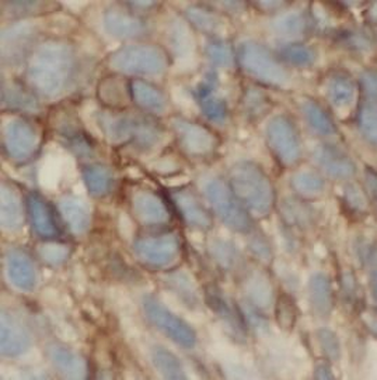 ORAI1 Mouse Monoclonal Antibody