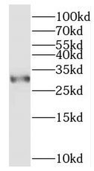 ORAI3 Rabbit Polyclonal Antibody