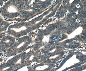 ORAI3 Rabbit Polyclonal Antibody