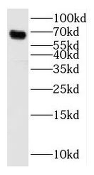 SPP1 Rabbit Polyclonal Antibody