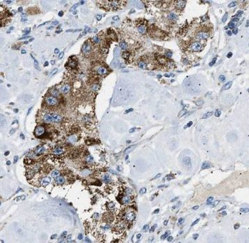 SPP1 Rabbit Polyclonal Antibody