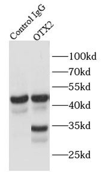 OTX2 Rabbit Polyclonal Antibody