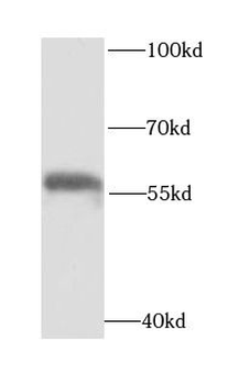 OXCT1 Antibody