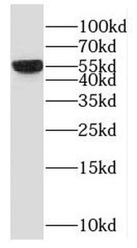 OXCT2 Antibody