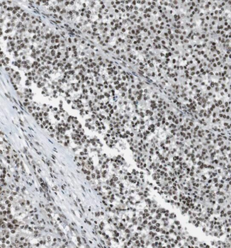 CDKN2D Rabbit Polyclonal Antibody