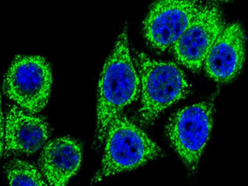 SQSTM1 Rabbit Polyclonal Antibody