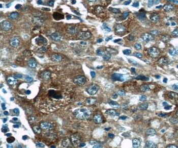 SQSTM1 Rabbit Polyclonal Antibody