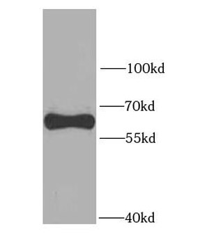 SQSTM1 Rabbit Polyclonal Antibody