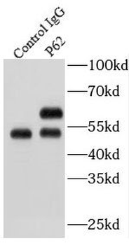 SQSTM1 Rabbit Polyclonal Antibody