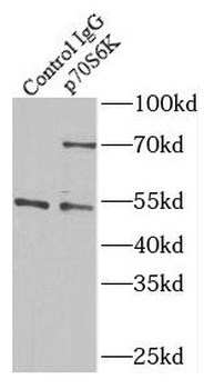 RPS6KB1 Rabbit Polyclonal Antibody