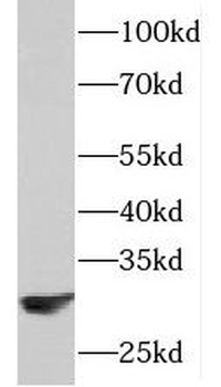 PAAF1 Rabbit Polyclonal Antibody