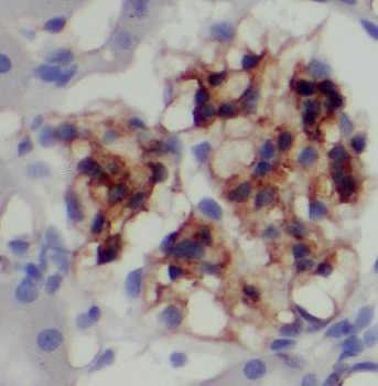 PAAF1 Rabbit Polyclonal Antibody
