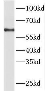 PACSIN2 Rabbit Polyclonal Antibody