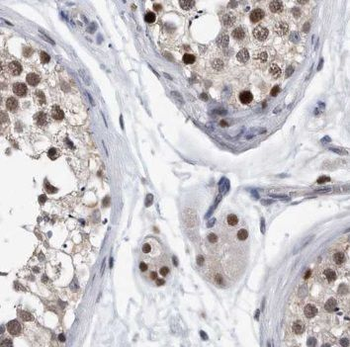 PAGE2 Antibody