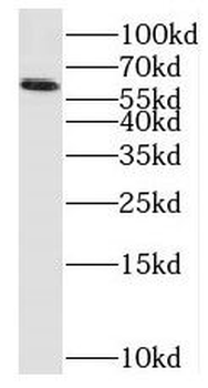 PAK1 Rabbit Polyclonal Antibody