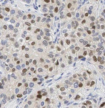 PAK1 Rabbit Polyclonal Antibody
