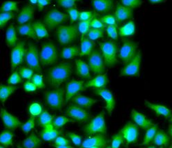 PAK2 Rabbit Polyclonal Antibody