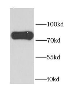 PAK6 Antibody
