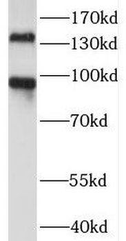 PALLD Antibody
