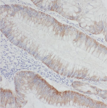 PALLD Rabbit Polyclonal Antibody